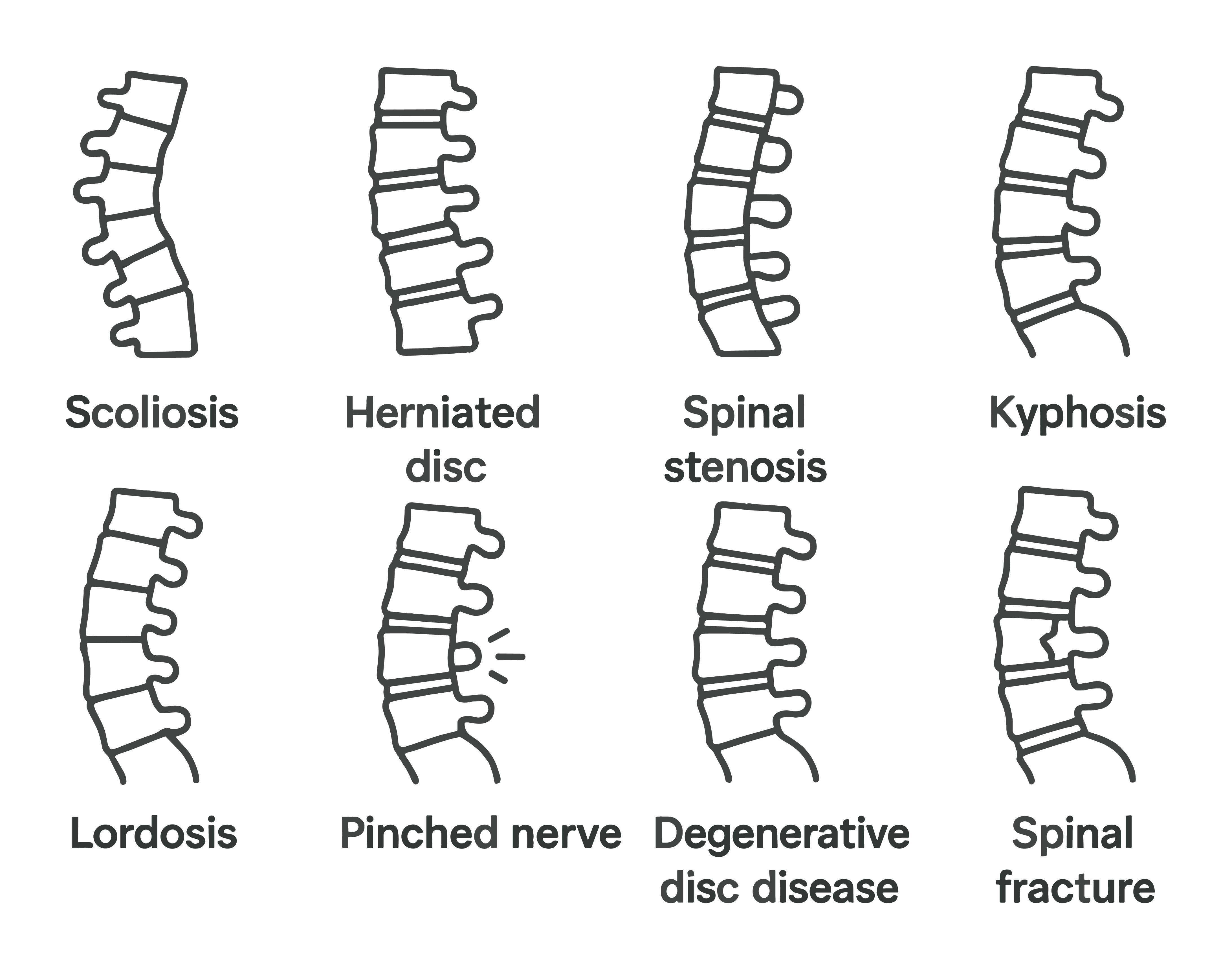 Spinal Disorders Treatment